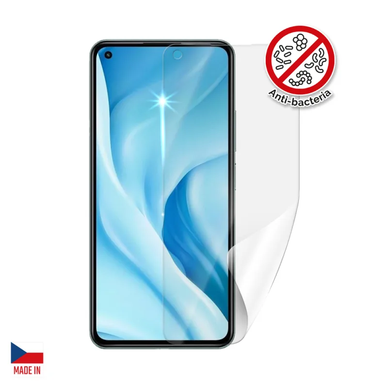 Screenshield Anti-Bacteria XIAOMI 11 Lite 5G NIE fólia na displej XIA…